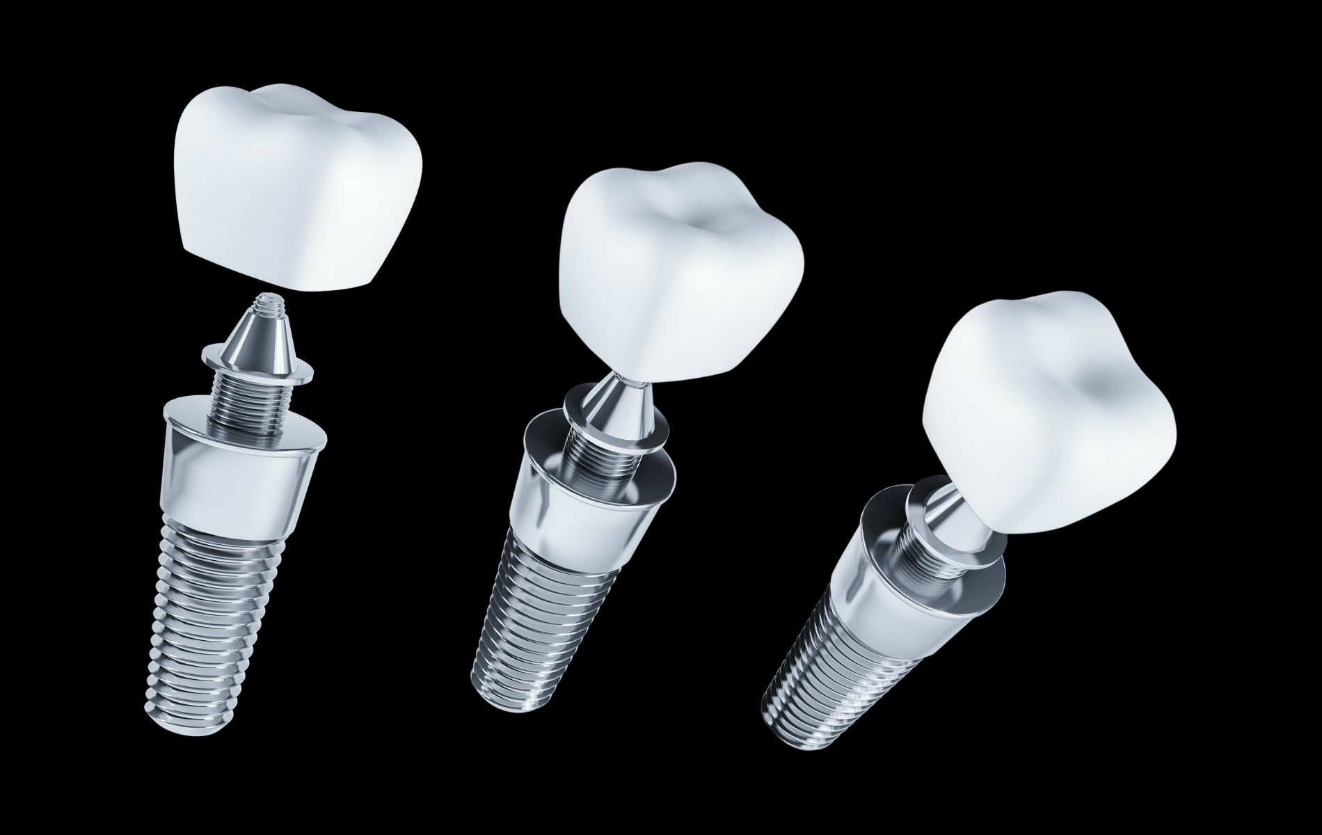 Dental Implants: An Innovative Solution for Tooth Loss