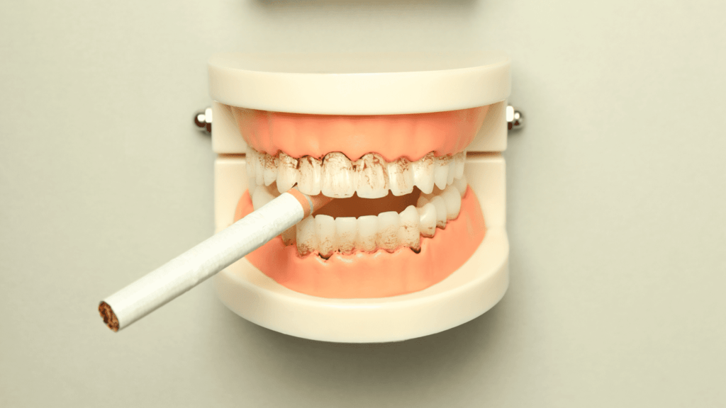 Tobacco Dental Health